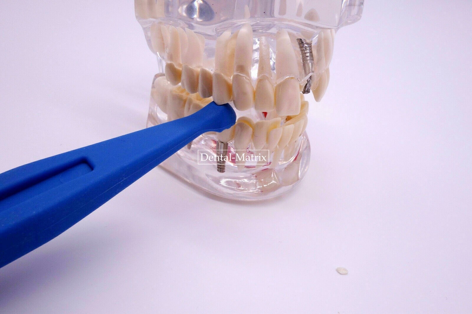 Dental Tooth Cleft Crack Detector Probe Fracture Locating Crown Bridge Seat 135℃