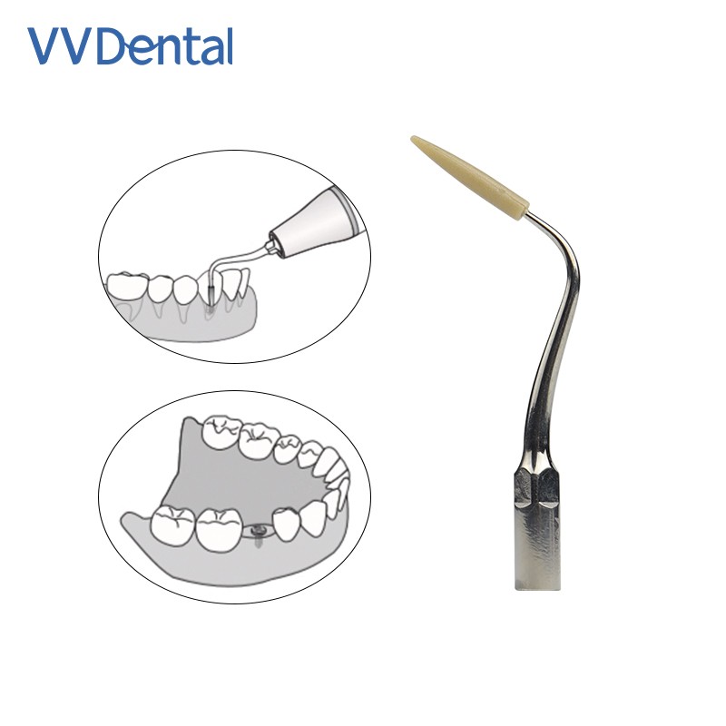 Dental Implant Maintenance Tip for clean the surfaces of implants restorations