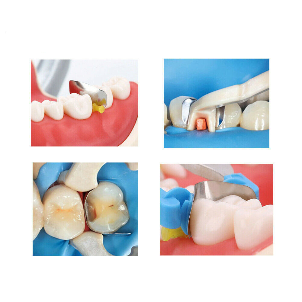 Dental Sectional Contoured System Matrices Matrix Bands Resin Refills Ring Clamp