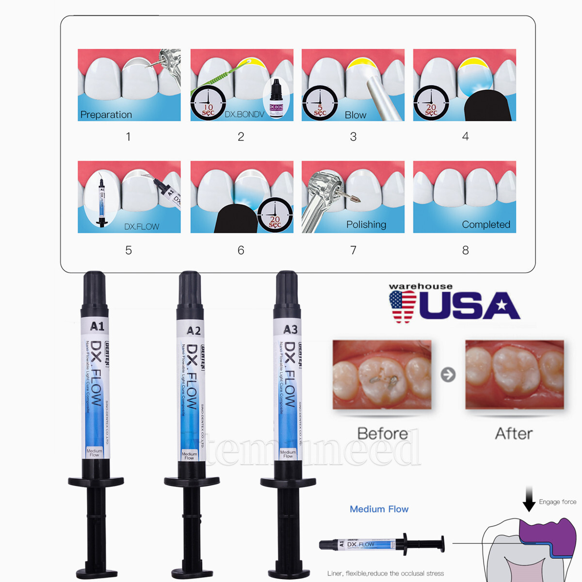 DX.FLOW DENTEX Flowable Medium Flow Light Cure Composite Resin A1 A2 A3