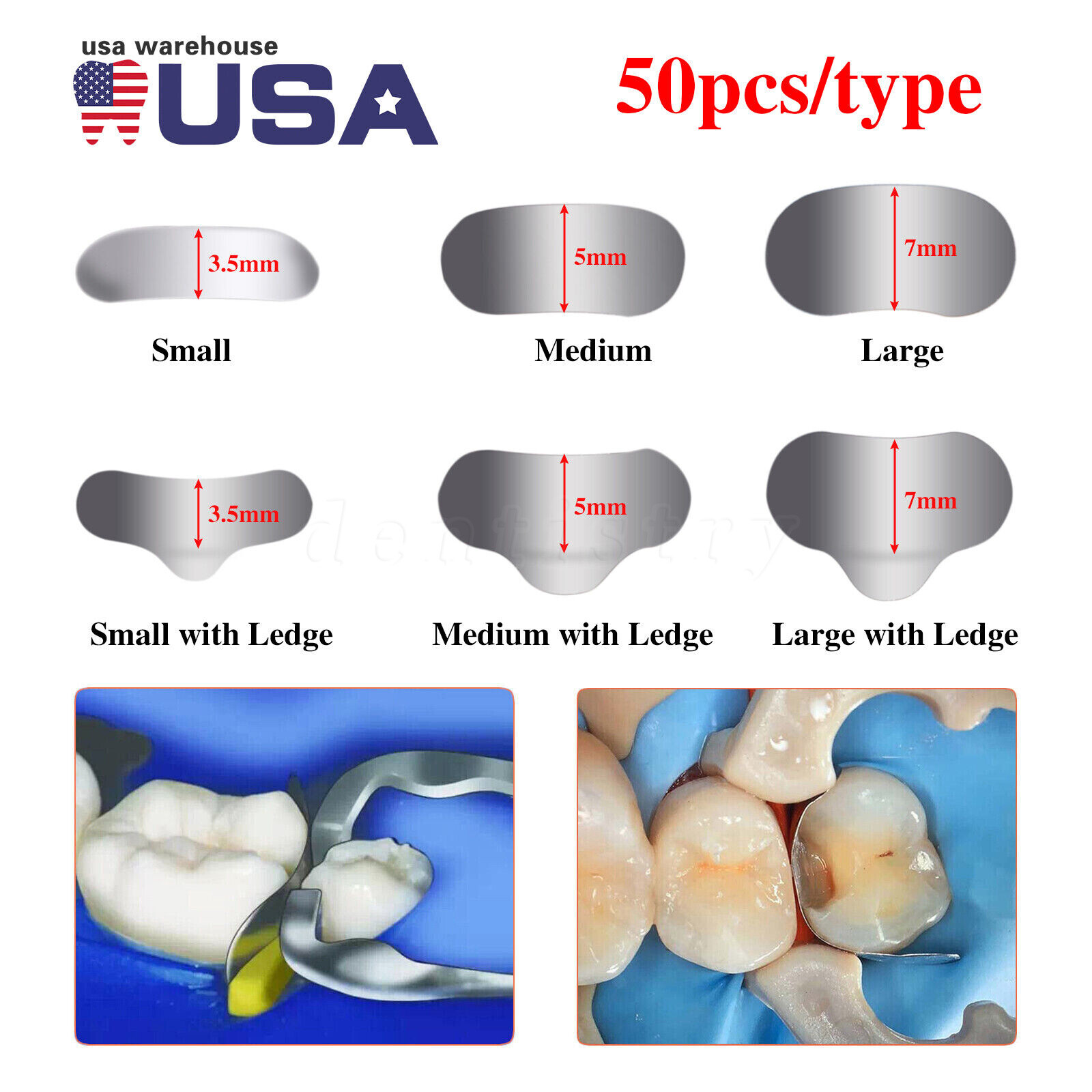 50 Pcs Dental Metal Matrices Sectional Contoured Matrix Refill Hard band S/M/L