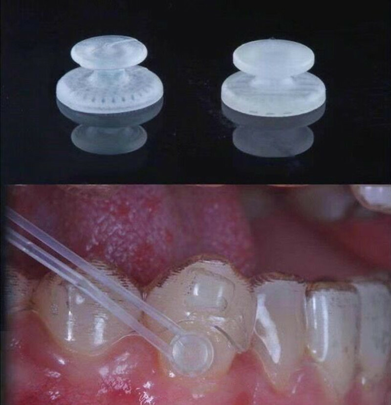 Dental Lingual Button Ceramic Clear Invisable Retainer Aligner Bondable Round