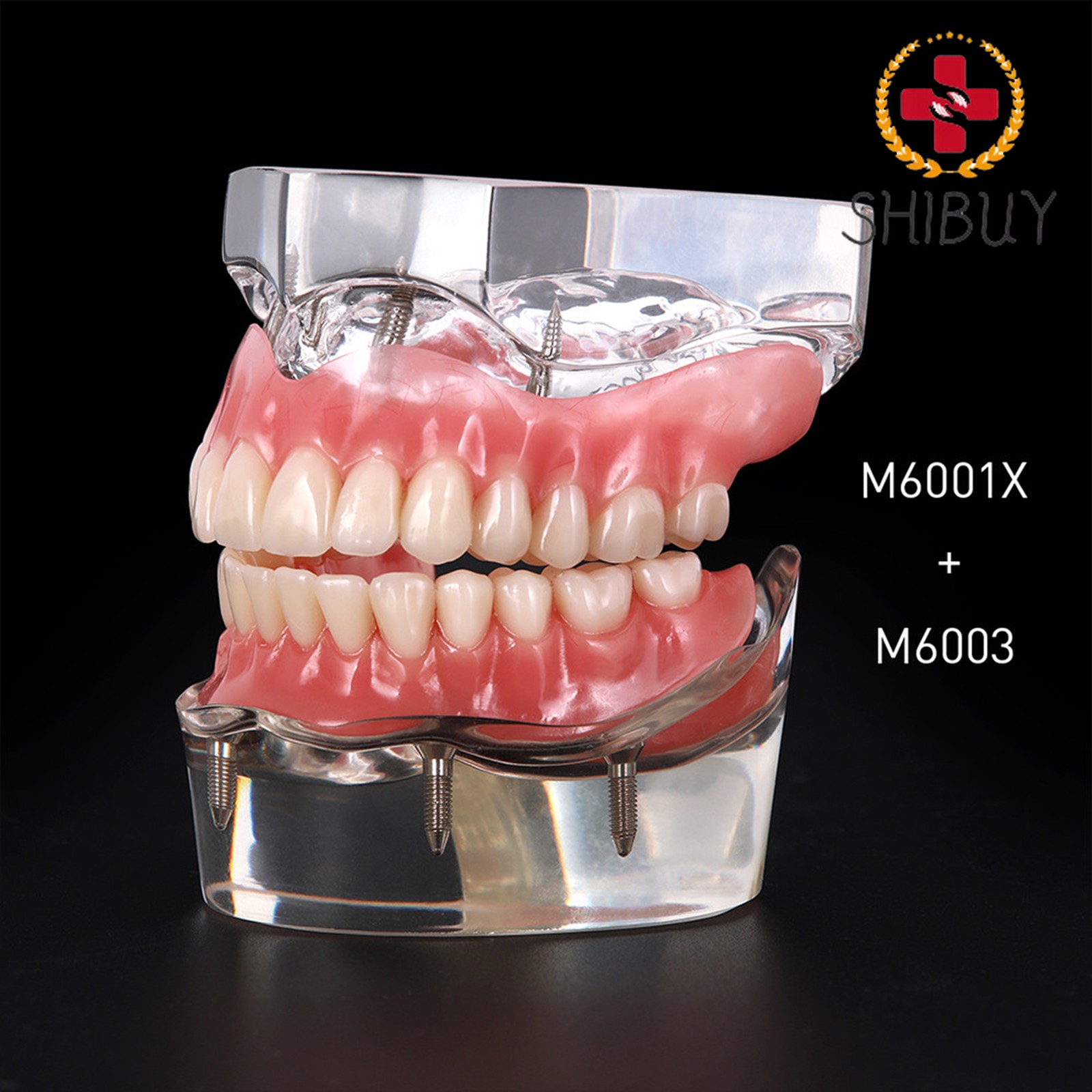 For Upper/Lower Teaching Study Dental Implant Model, Removable Overdenture