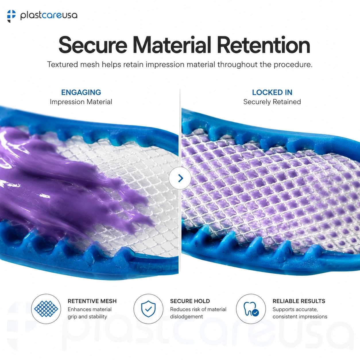 50 Posterior Blue Disposable Dental Bite Registration Trays, Impression Trays…