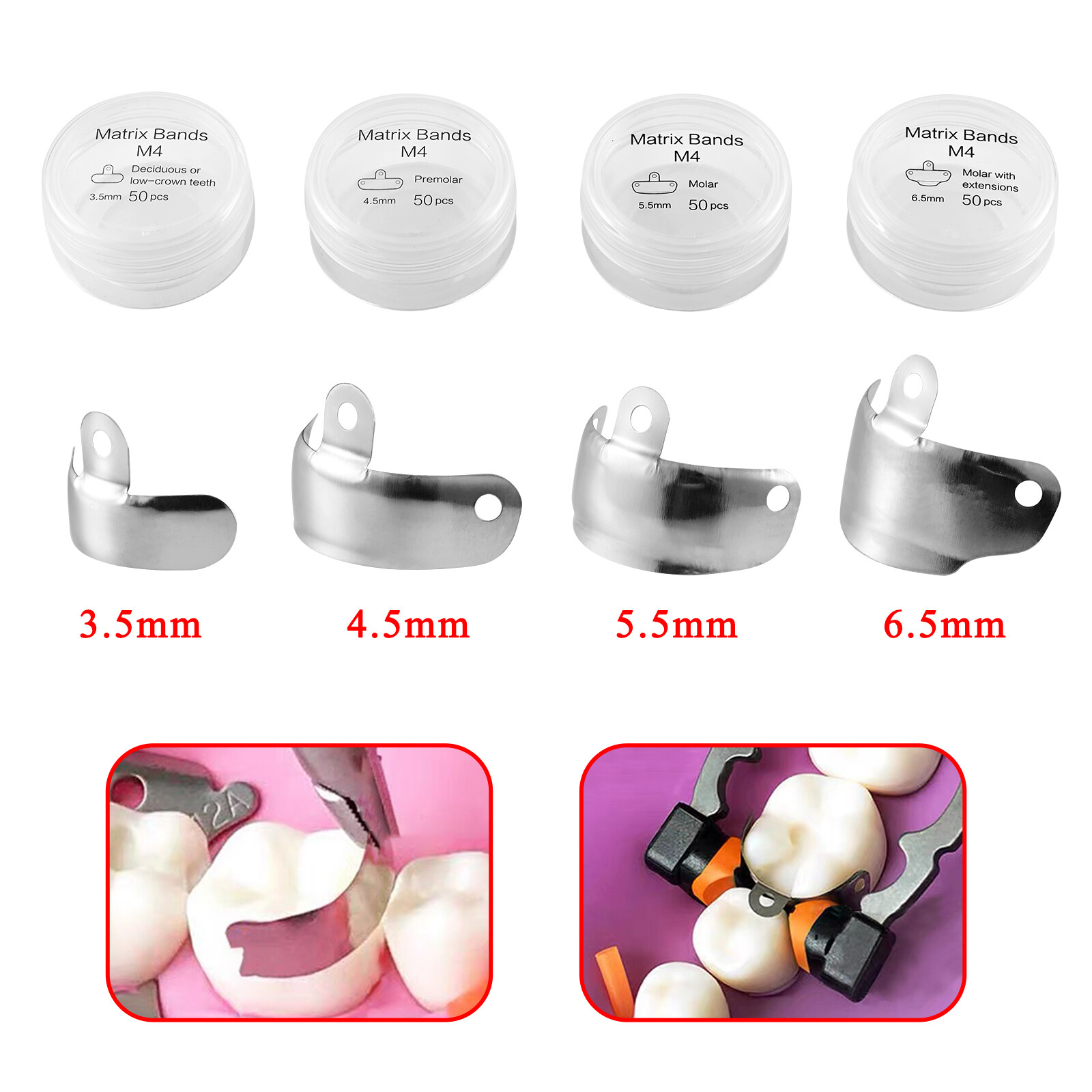 50pcs Dental Metal Matrices Sectional Contoured Matrix Refill Soft Band S/XL