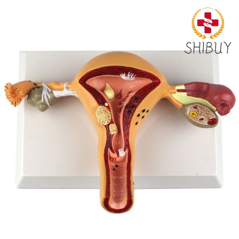 Human Model Female Reproductive Uterine Vaginal Ovarian Uterine Teaching Mold