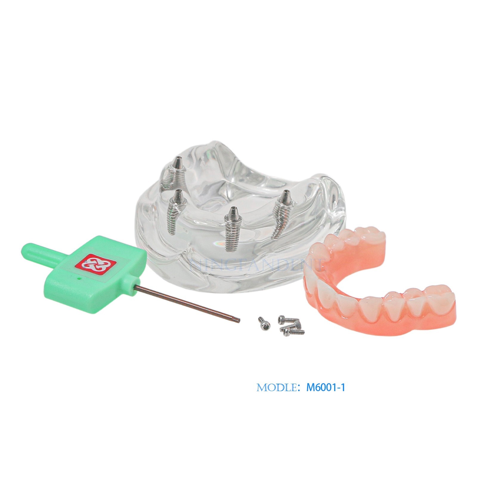 Dental All-on-4 Overdenture Implant Model, Upper/Lower Jaw-Clear,With 4 Screw
