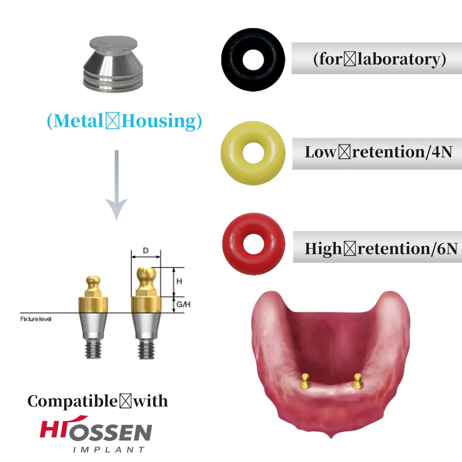 20PCS Dental Hiossen O-Ring Kit 4N/6N Lab Metal for Overdenture Ball Abutment
