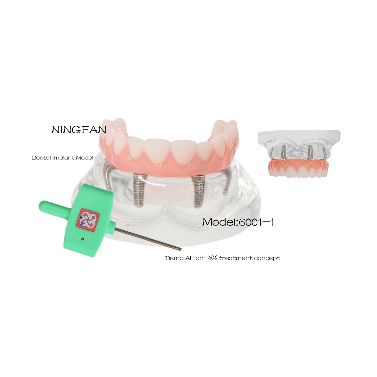 USAll on 4 Dental Implant Model Overdenture Upper Jaw 4 Implant Clear Detachable