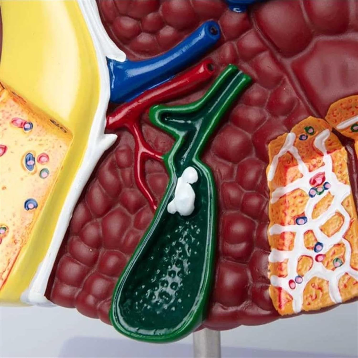 Pathological Liver Anatomical Model 1:1 Human Liver Model Anatomy Display Study