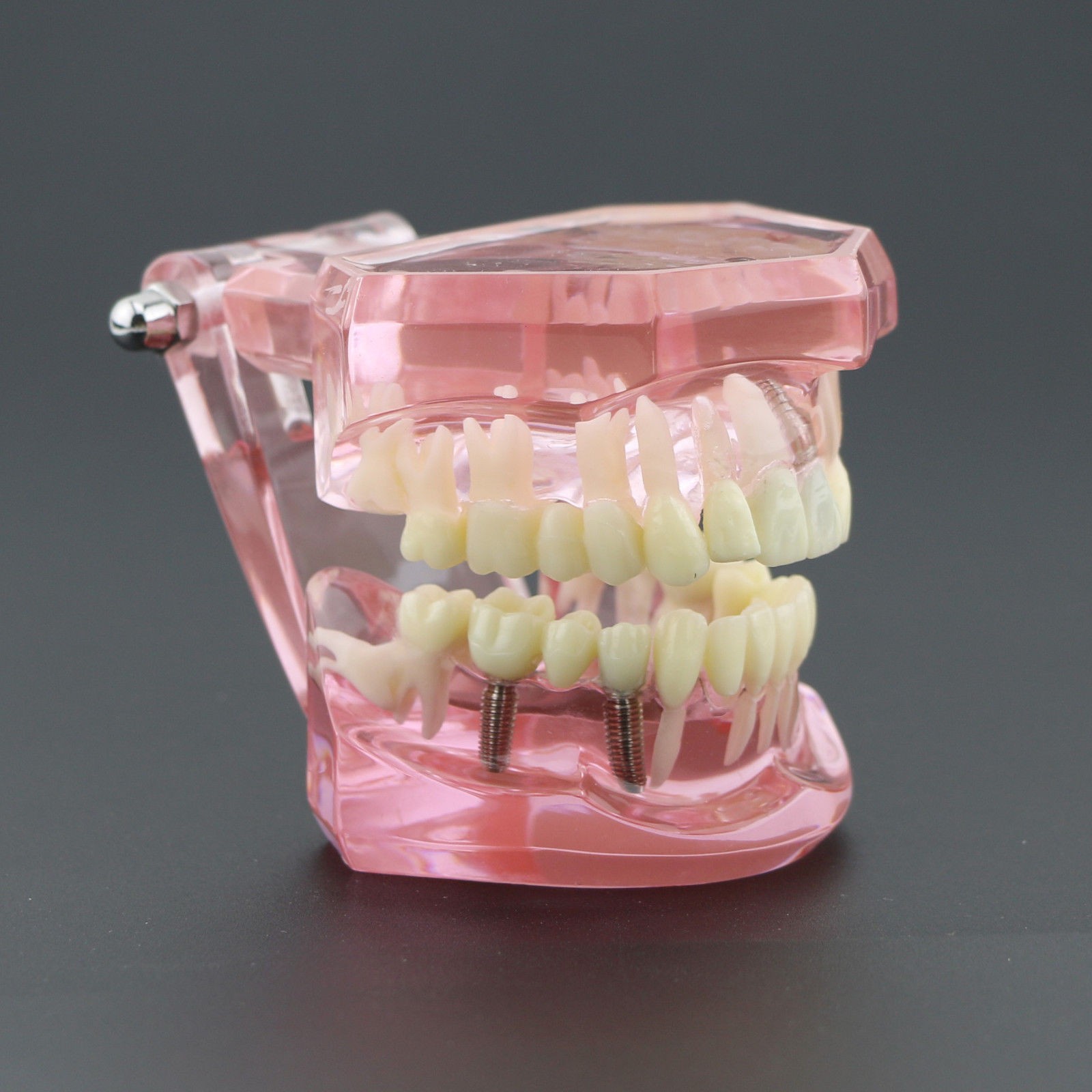 Dental Implant Teeth Model Teach Study Demo Restoration Pathology #2001 Pink