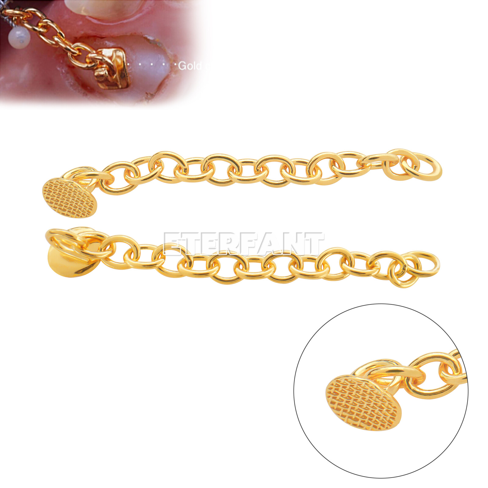 ETERFANT Dental Ortho Lingual Buttons Traction Chains Round Plated Silver/Gold