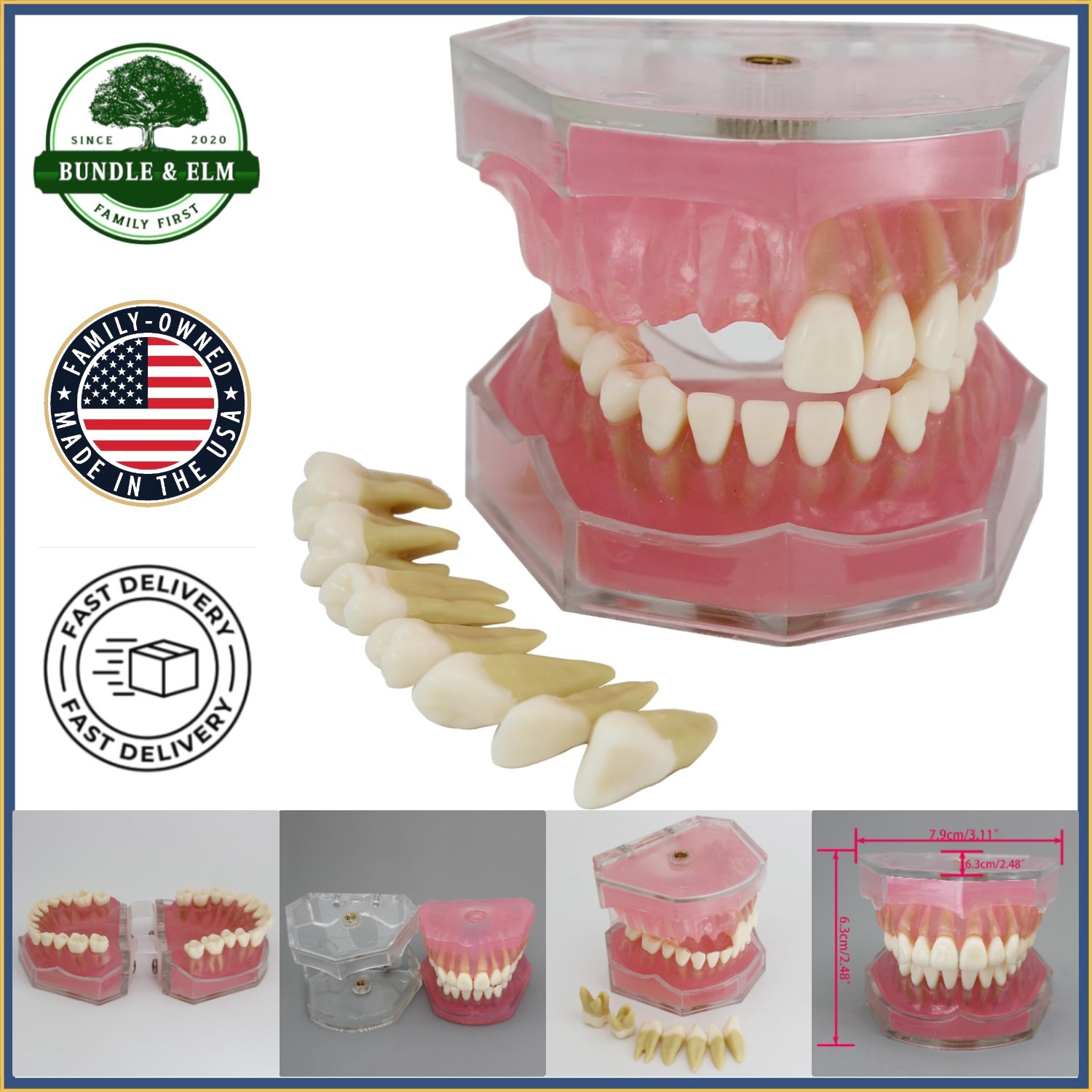 Dental Implant Model with Removable Teeth and Soft Rubber Gingiva for Training