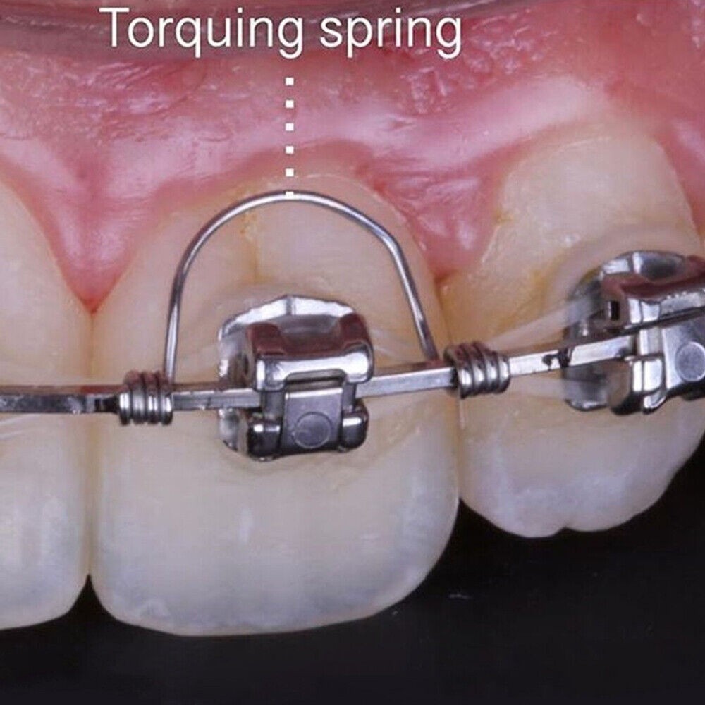 Dental Orthodontic Torquing Torque Rectangular Spring Anterior Teeth Wire 16*22