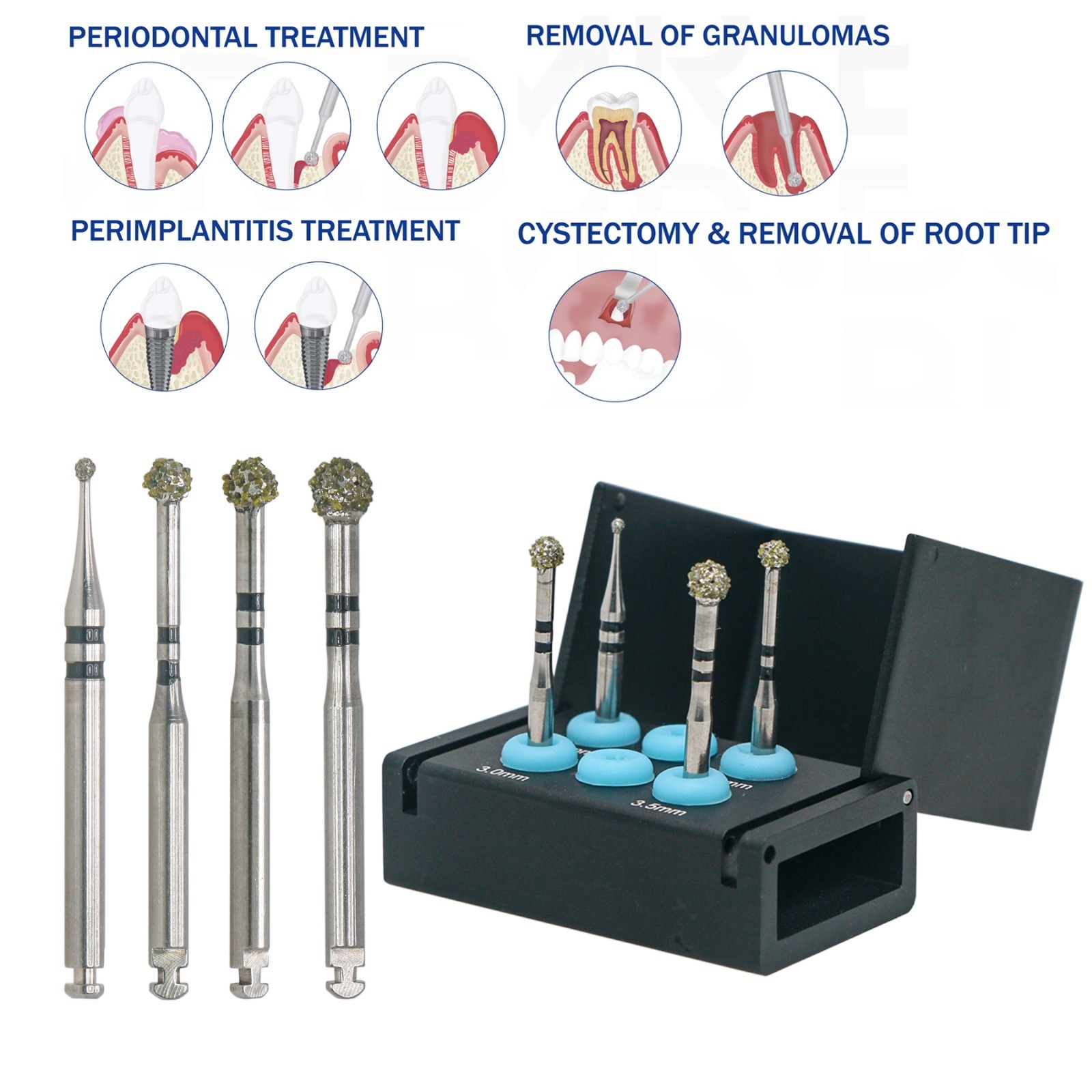 4Pcs/Kit Degranulation Burs Kit Osseous Debridement Remove Bone Tissue Remnant