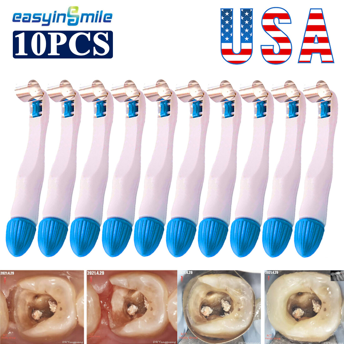 Dental Profecto Matrix Bands Molar Restoration Tofflemire Matrix Bands 6MM 10pcs