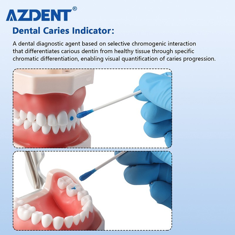Dental Caries Indicator Dye Dentin Caries Detector Locating Root Canal Orifices