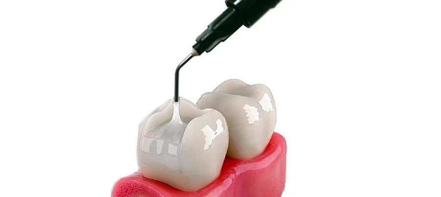 Dental Ivoclar Tetric N-Flow Bulk Fill Restorative Composite 2gm SHADE IV A