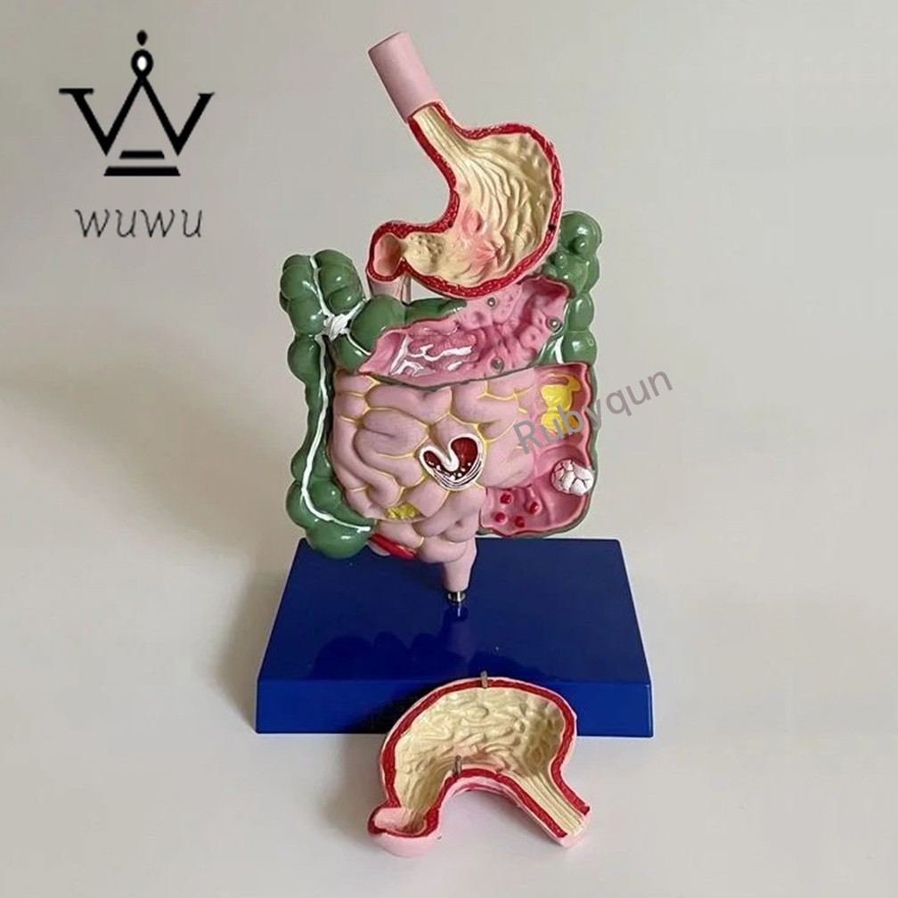 Human Digestive System Model Stomach Esophagus Stoh Large Small Intestine Ileum