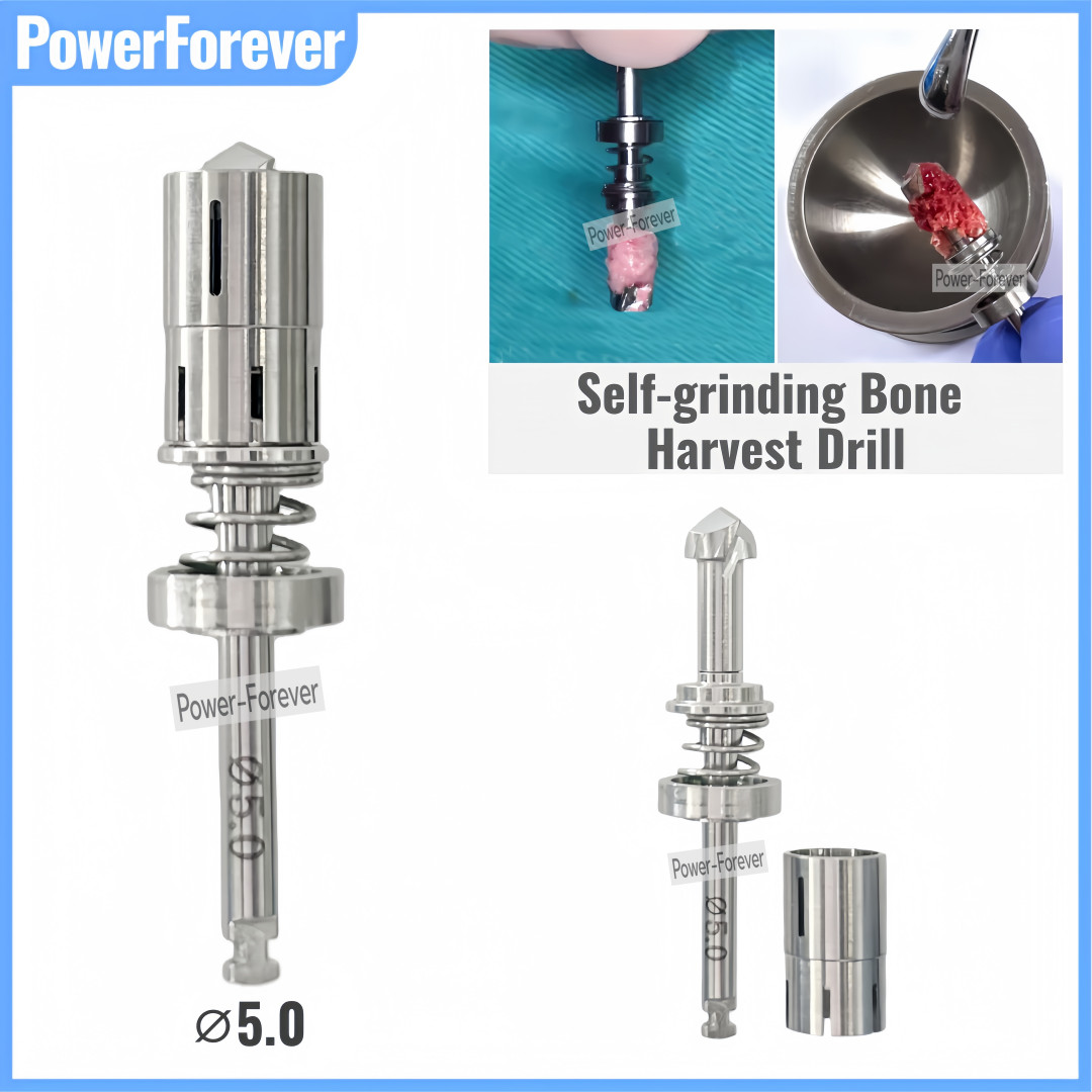 ⌀5.0 Dental GBR Self-Grinding Spring Bone Harvest Drill Autogeneous Trephine Bur