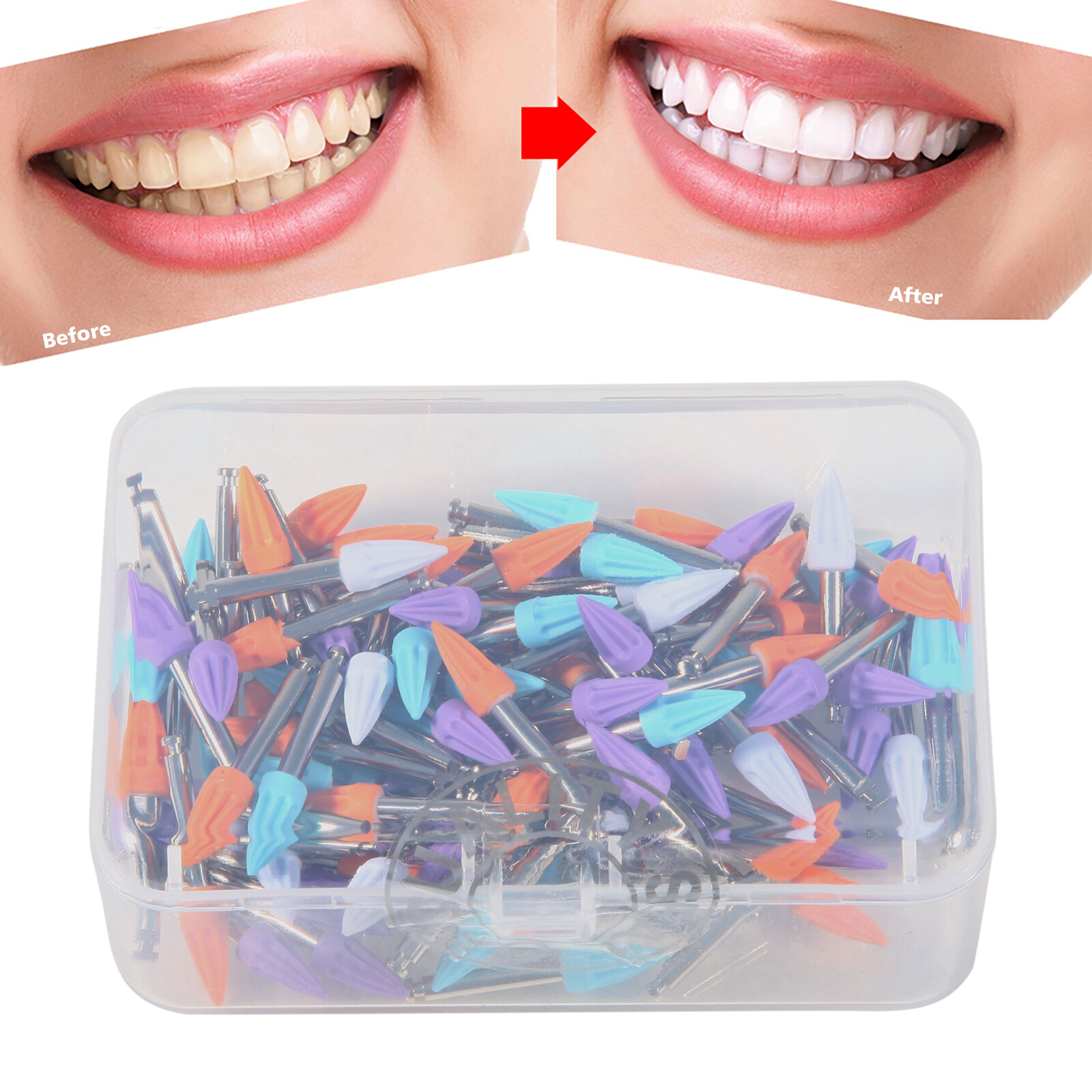 100PCS Prophy Cup Latch Type RUBBER DENTAL TOOTH POLISHING CUP Tapered shape
