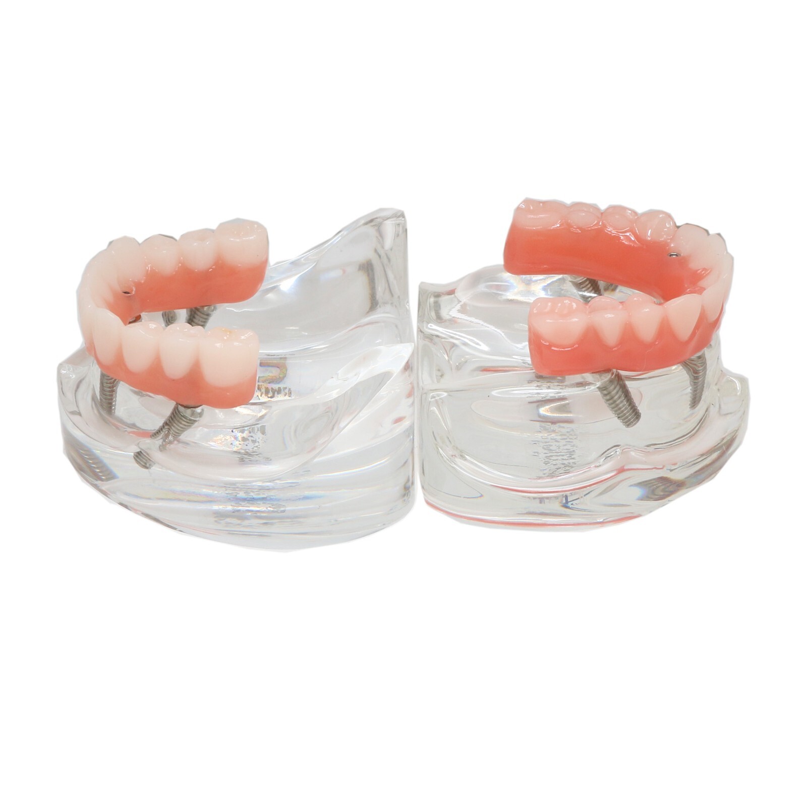 US Dental Implant Overdenture All-on-4 All-on-6 Model Upper/Lower jaw 4/6 Screws