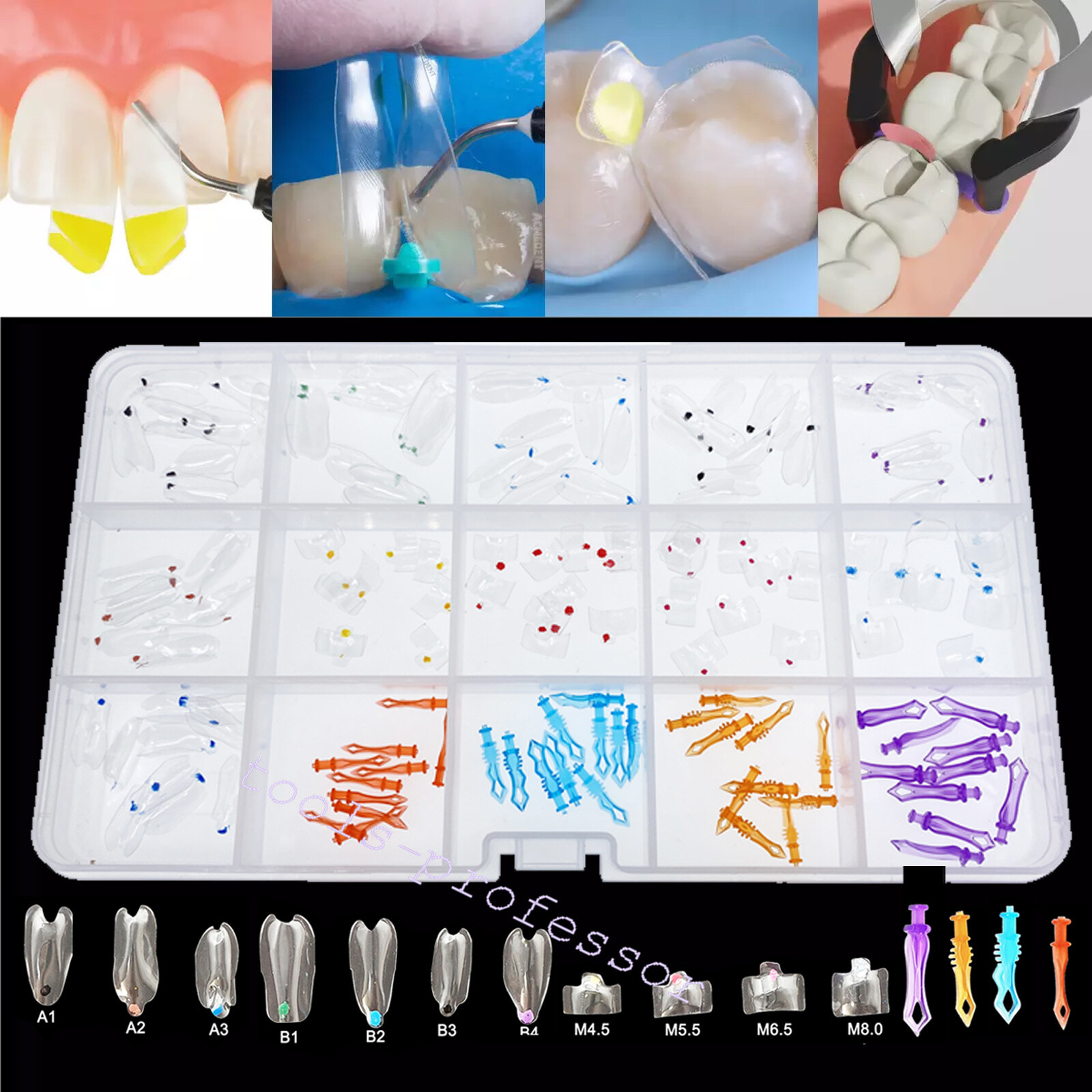 Dental Clear Matrix Anterior Posterior Restorative BT Bow Matrices Fit BioClear