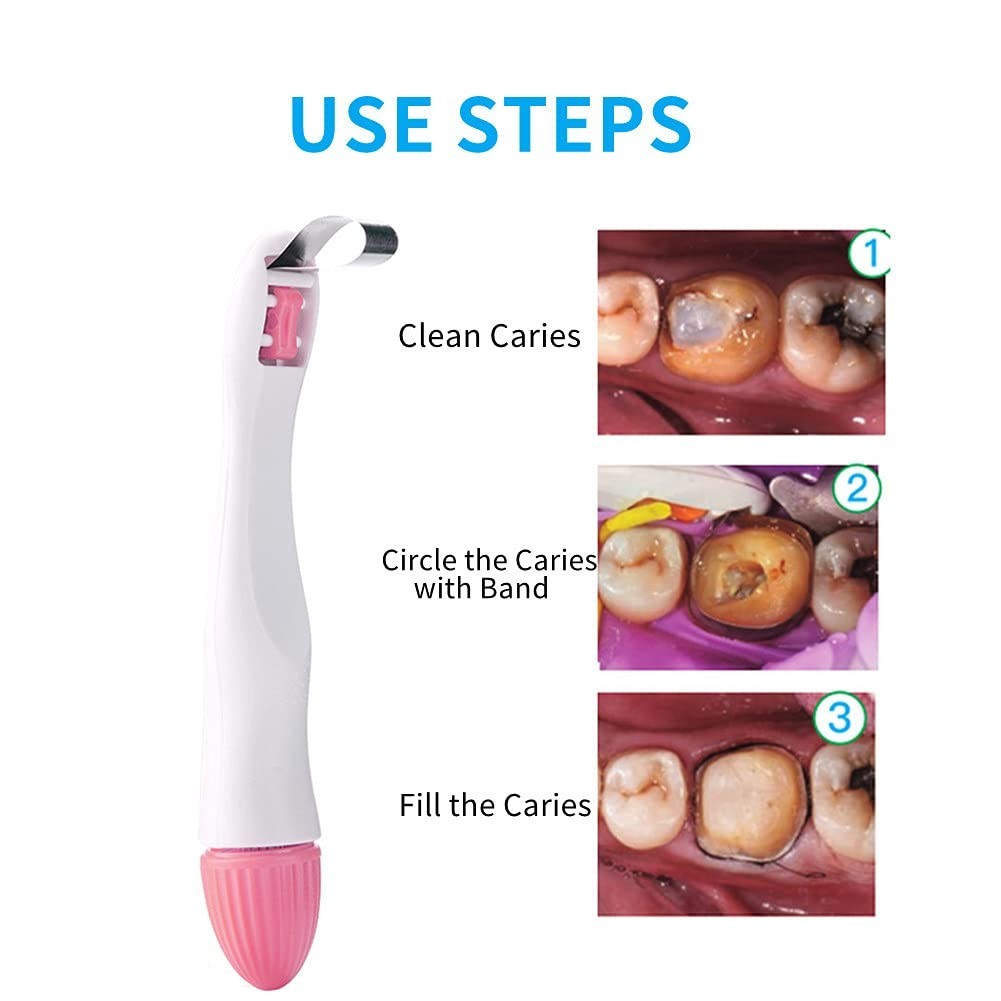 EasyInsmile Matrix Profect System 50 Bands Single-Use Direct Restorations Dental