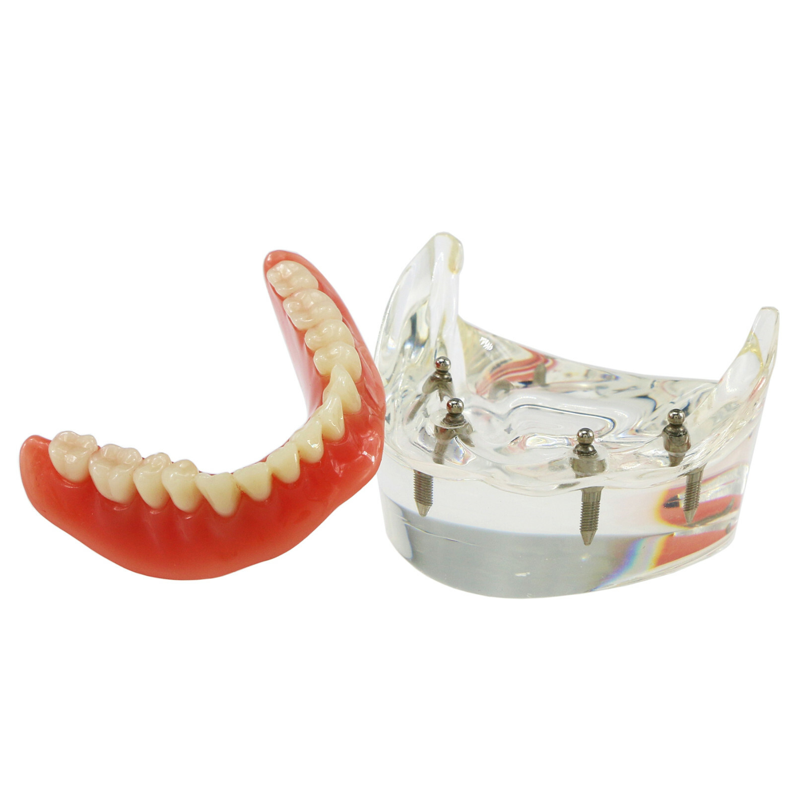 Dental Typodont Teeth Model Overdenture Lower Inferior 4 Implants Demo M6003