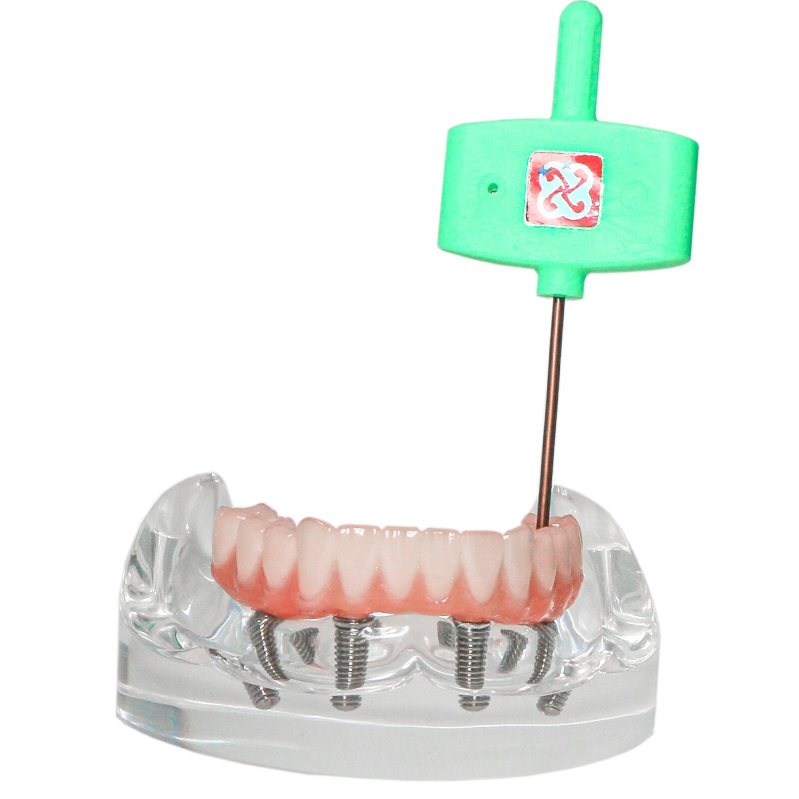 Dental Transparent Lower Jaw Malone Bridge All-on-4 Overdenture Typodont Model