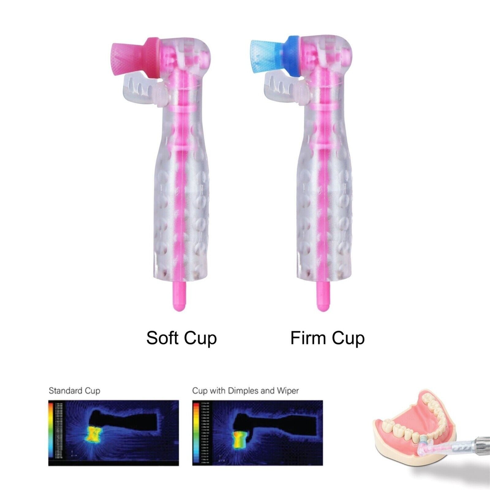 Lotus Technology AntiSplatr disposable prophy angle (Multi)