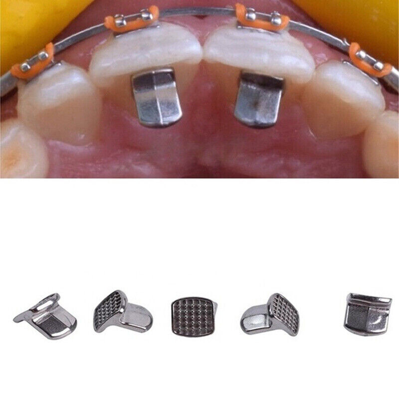 50 Pcs Dental Orthodontic MIM Bite Turbos Tongue Tamers Monoblock Bondable Hinge