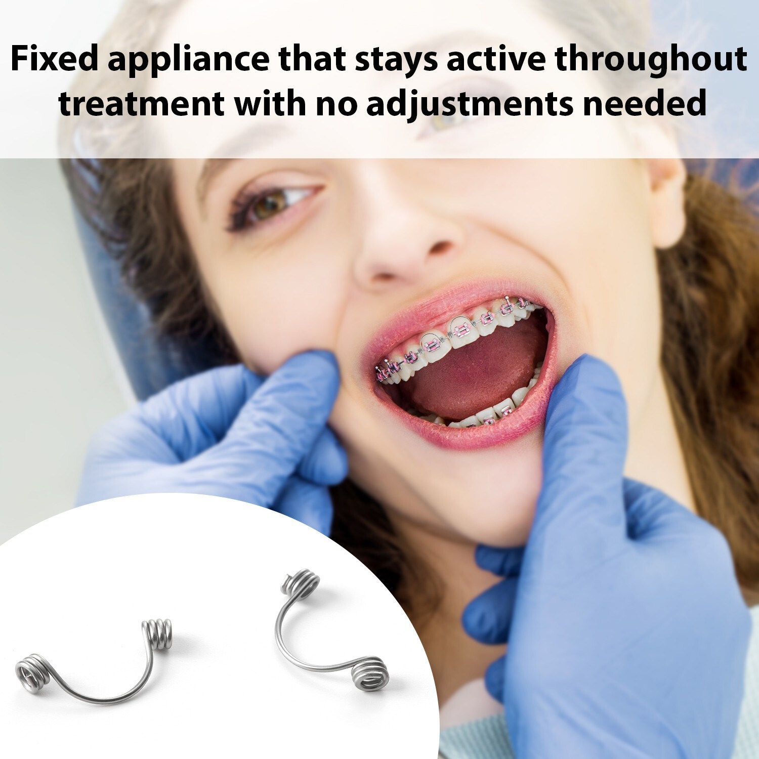 Dental Orthodontic Torquing Torque Rectangular Spring Anterior Teeth Wire 16*22