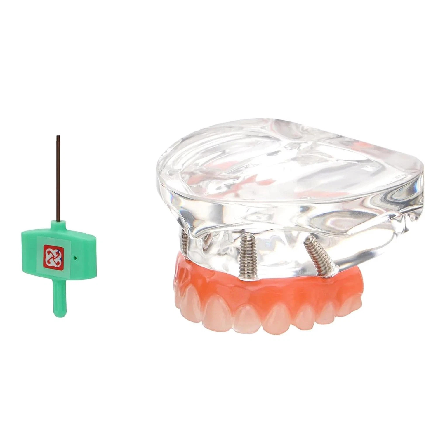 Dental Overdenture Implant Model All-on-4/6 Upper Jaw Restoration 4/6 Screws