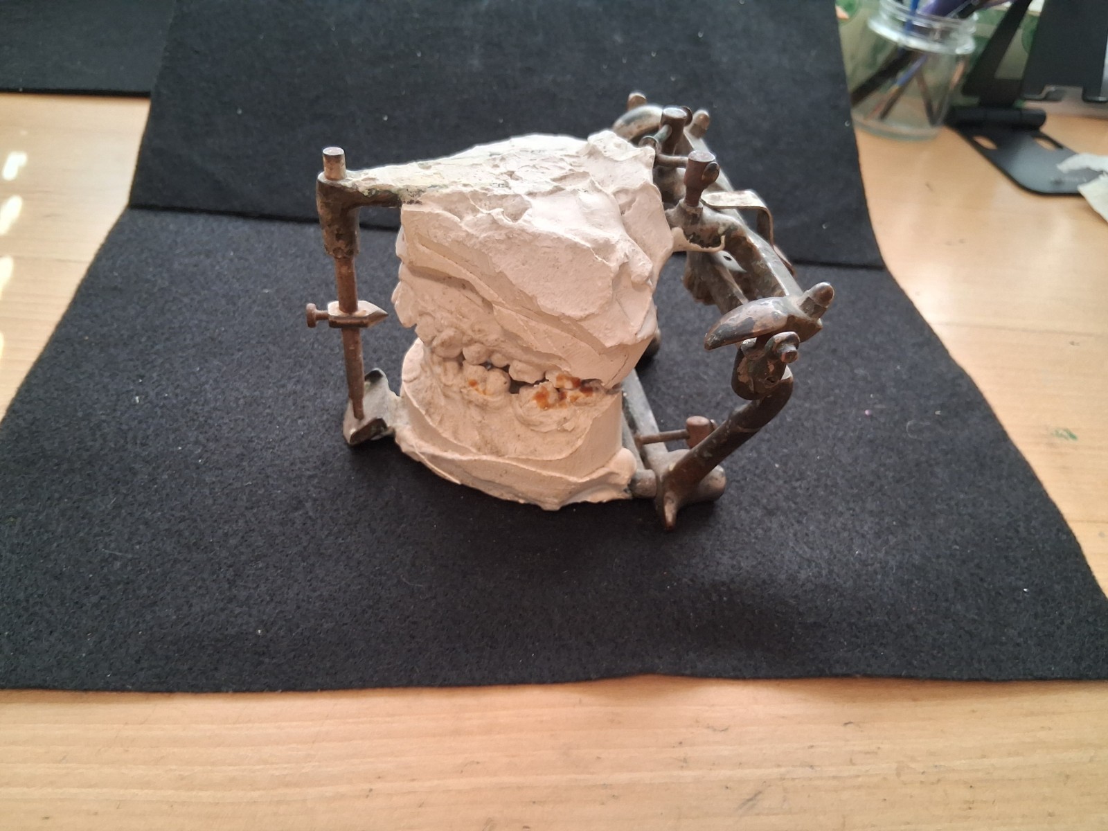 Antique dental articulator patented 1912. Dentists Supply co. New York