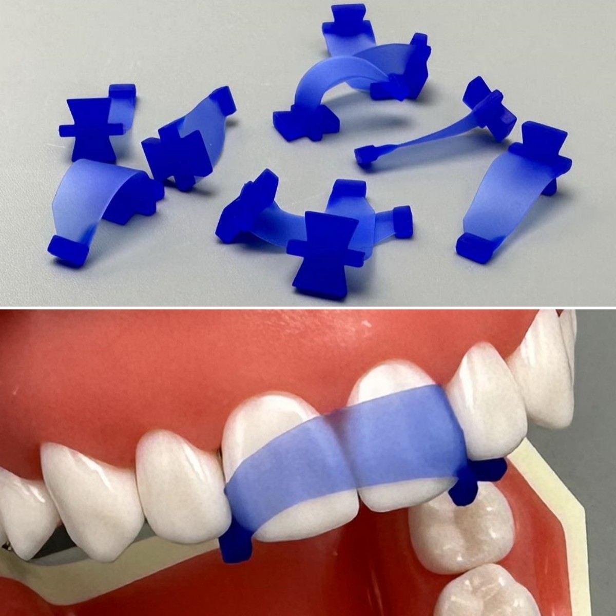 10Pcs Dental Butterfly Matrix Dental Isolating Matrices Wedges Anterior Strip
