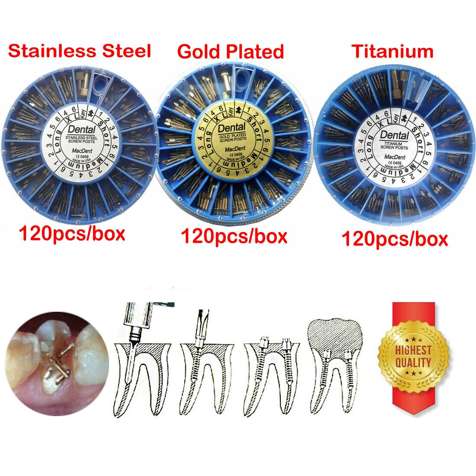Dental Endodontic Screw Posts Kit SST/24K Gold Plated/Pure Titanium Nordin Type