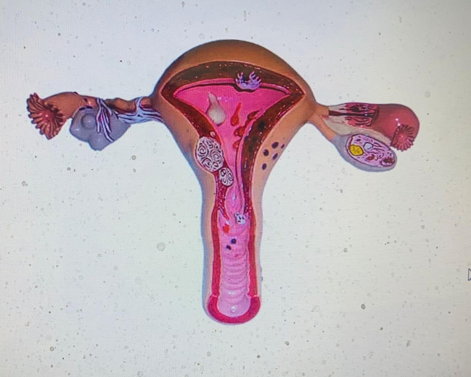 Uterus And Ovary Model Female Reproductive Organ Model Human Anatomy