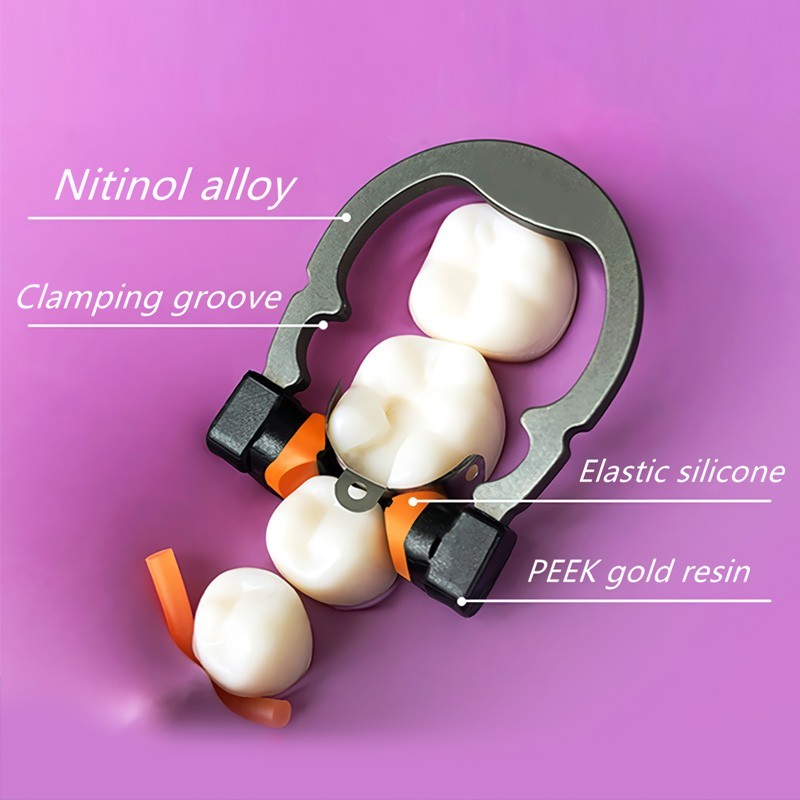 Dental Matrix Ring Titanium Clamp Sectional Matrice Clamp Fit Palodent V3 System