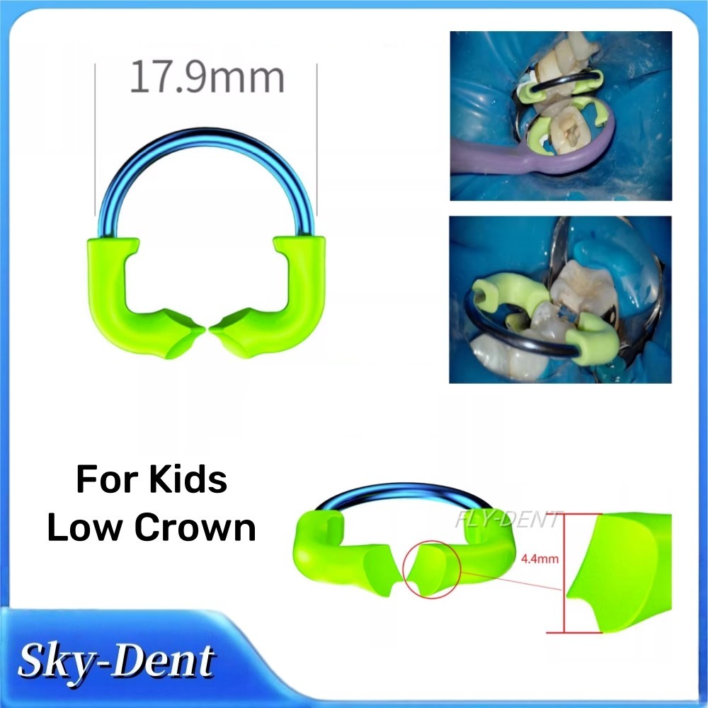 For Kids Low Crown Matrix Retainer Ni-Ti Clamping Ring Dental Teeth Restoration