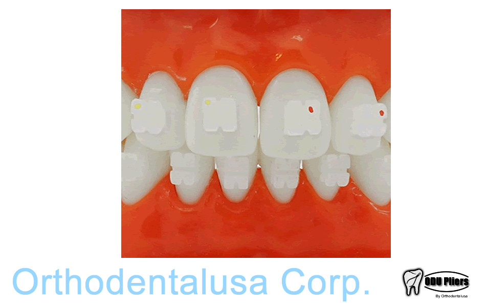 ORTHODONTIC Ceramic Bracket Roth .022″ Hook 3,4,5 / 20 pcs/set / 3 line base