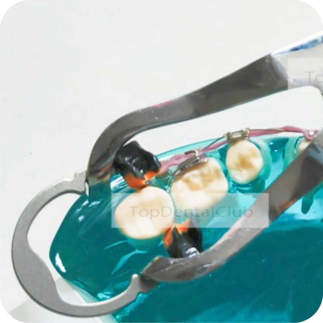 Dental Sectional Matrix Narrow Ring Titanium Clamp Plier Fit Garrison V3 Style