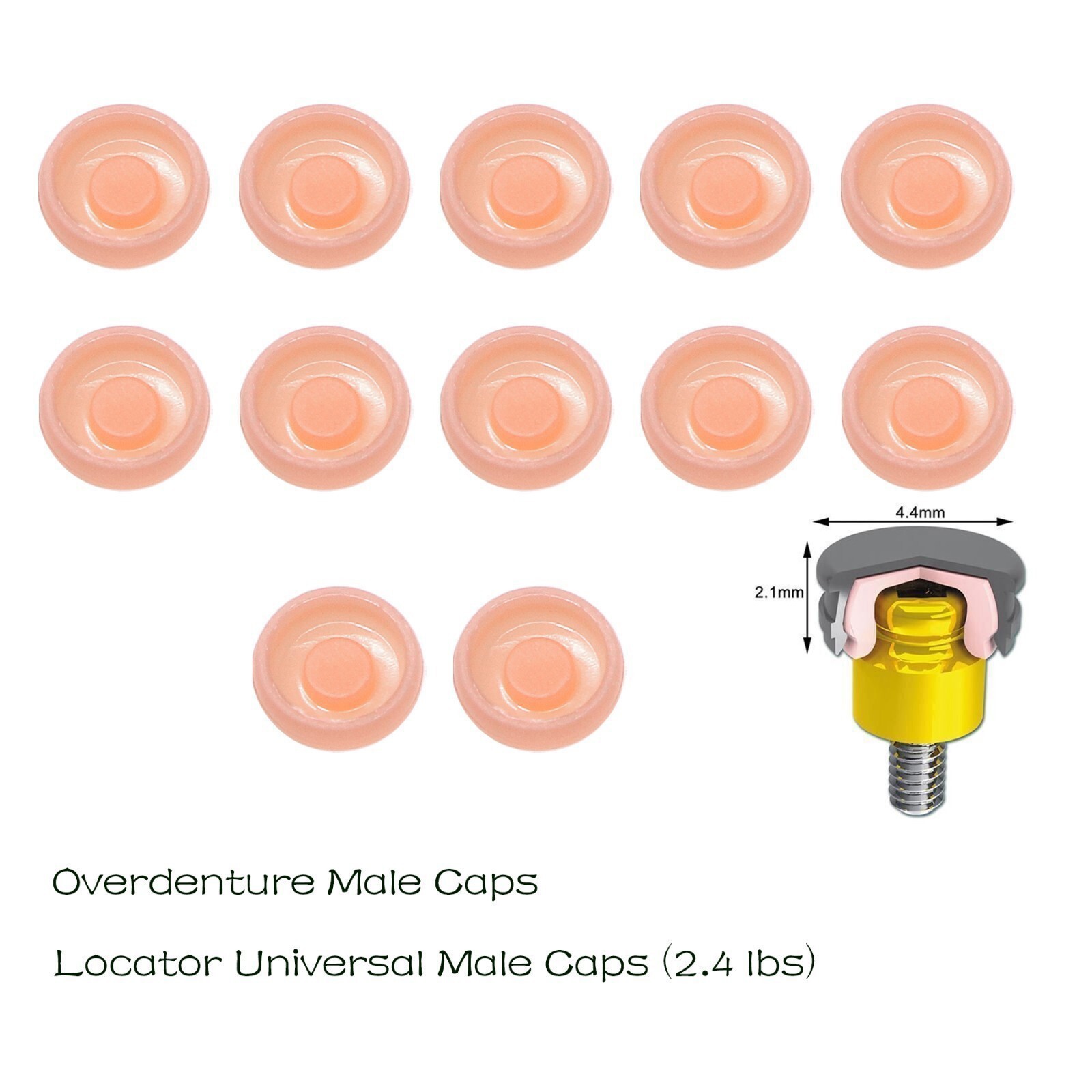 Dental Overdenture Abutment Retention Cap Locator male processing Inserts Set