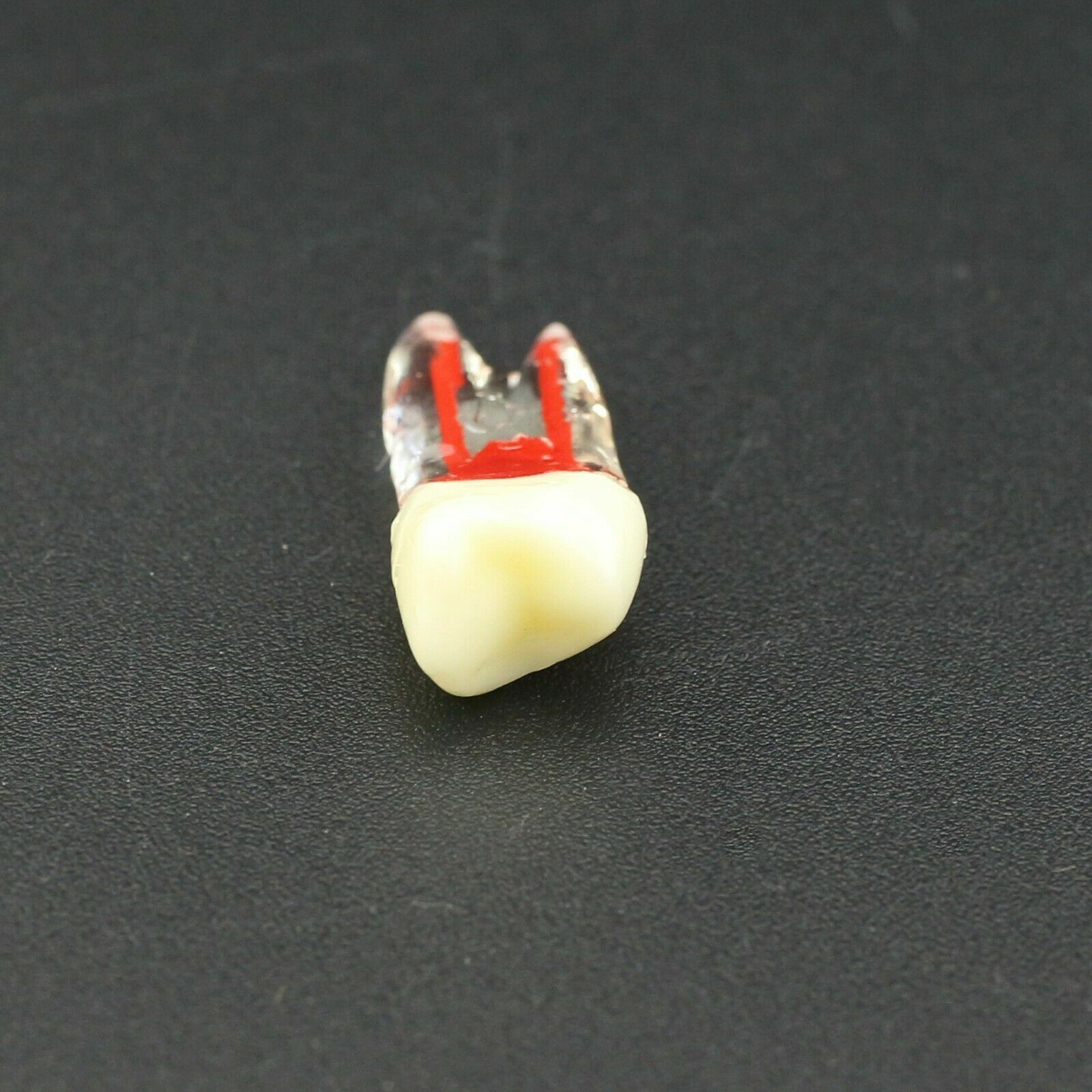 Dental Endo Root Canal Teeth Study Practice Model Fit for Kilgore Nissin