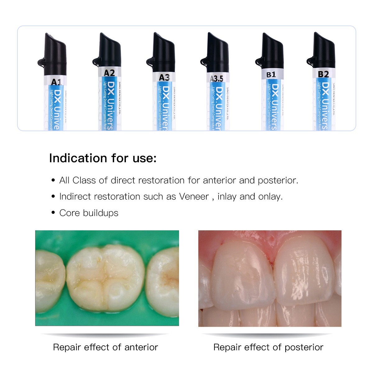 Dental Light Cure Composite Resin Etching Adhesive Kit/ Heater/Curing Light Lamp