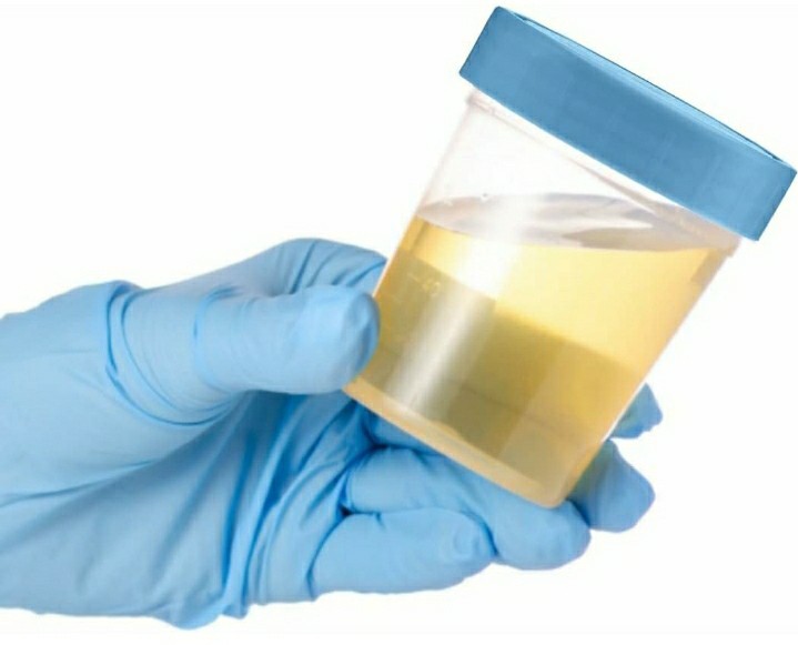 Lot Of 25 – Specimen Cups with Leak Proof on Lids 4oz Clear Non-Sterile