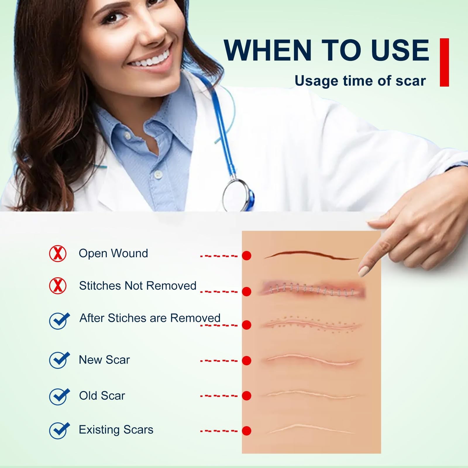 Silicone Scar Sheets (1.6” x 120” Roll-3M), 120×1.6 Inch (Pack of 1), Brown