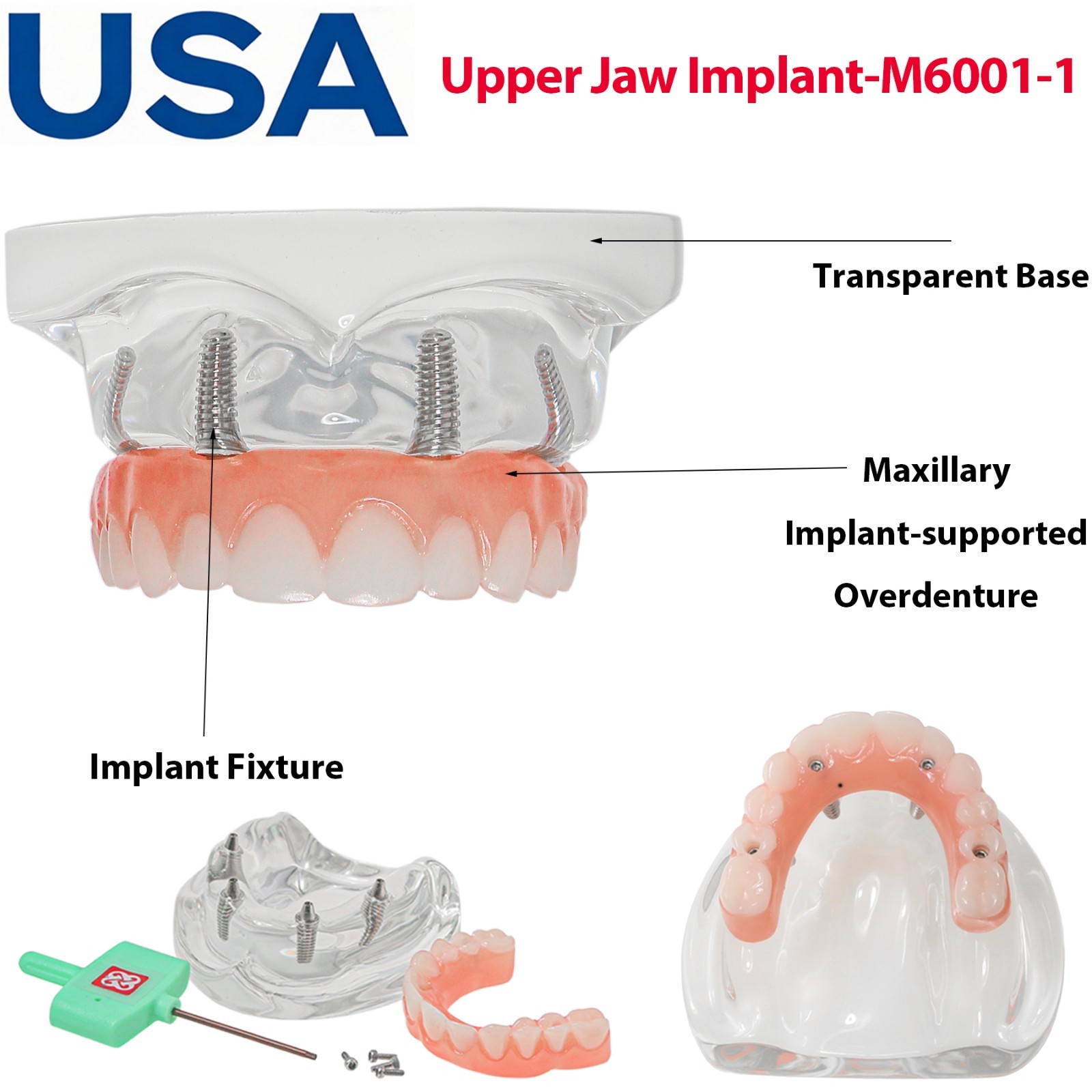 US Dental Overdenture All-on-4 Implant Treatment Model Upper Jaw 4 Screw M6001-1