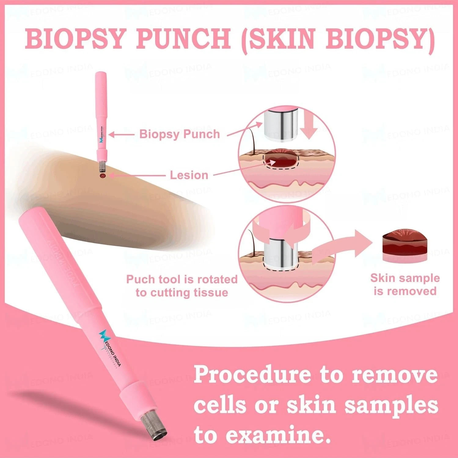 5.0MM Biopsy Punch Disposable Sterile Dermal Pierce Individual Sealed Punch 100P
