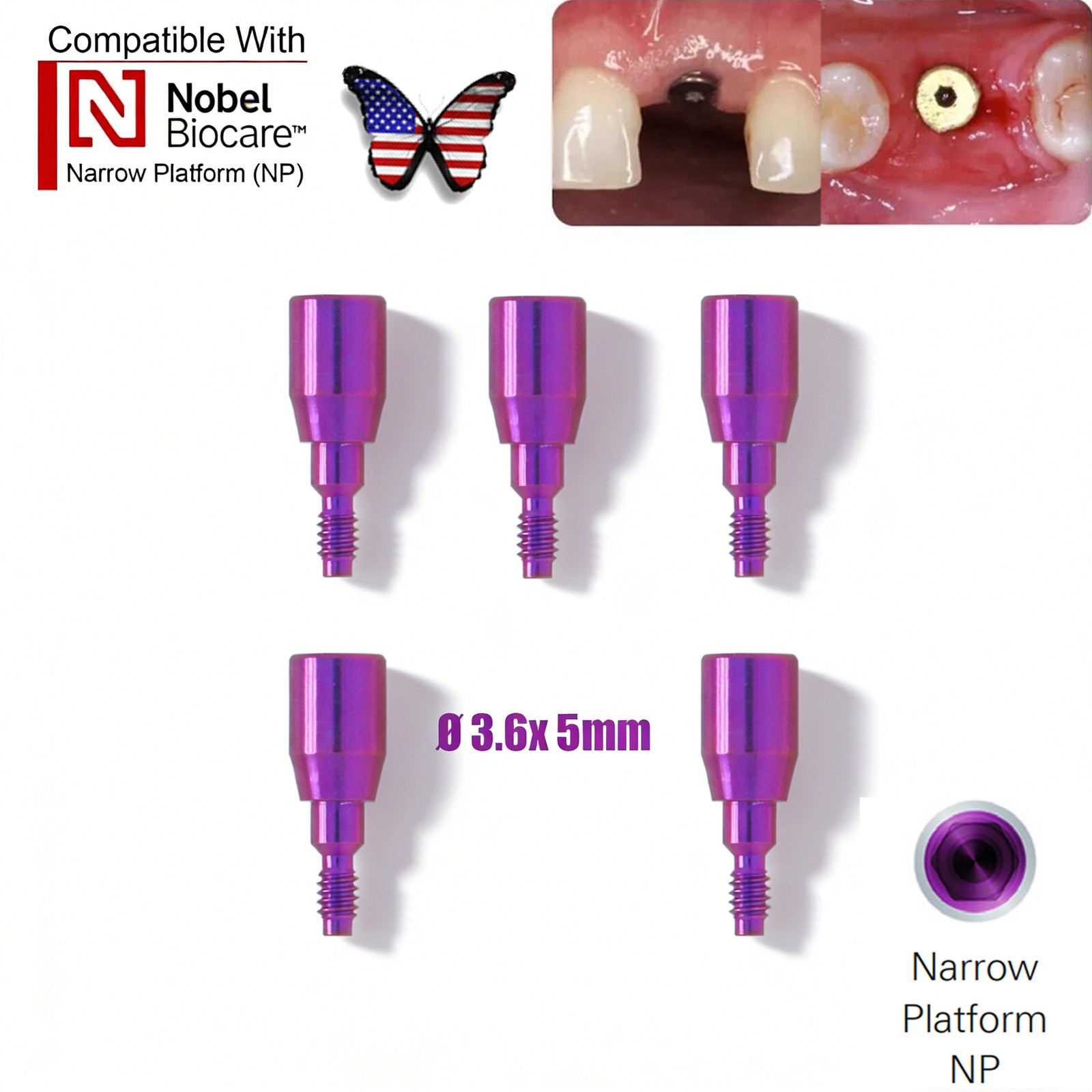 Dental RP NP Healing Abutment Compatible NobelActive Internal Conical Connection